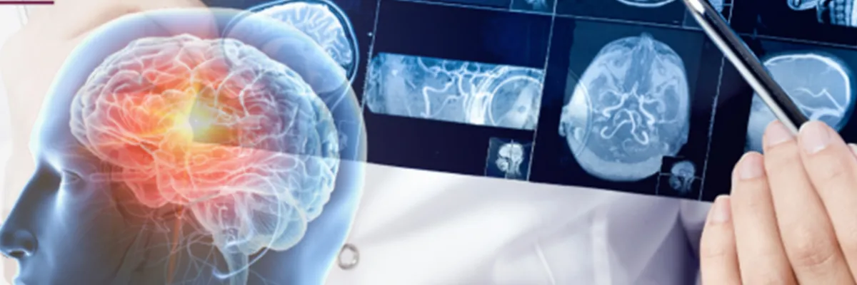 Neurocirugía Para Médicos Generales