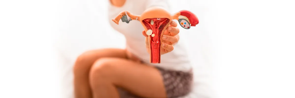 ENDOMETRIOSIS