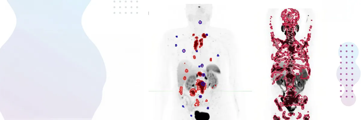 mediicinanuclear