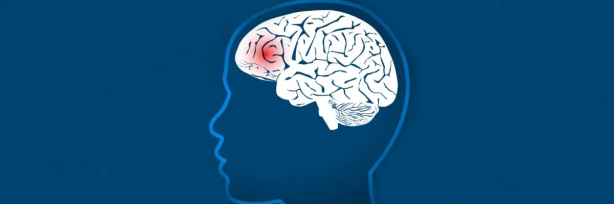  Semiología en Epilepsia