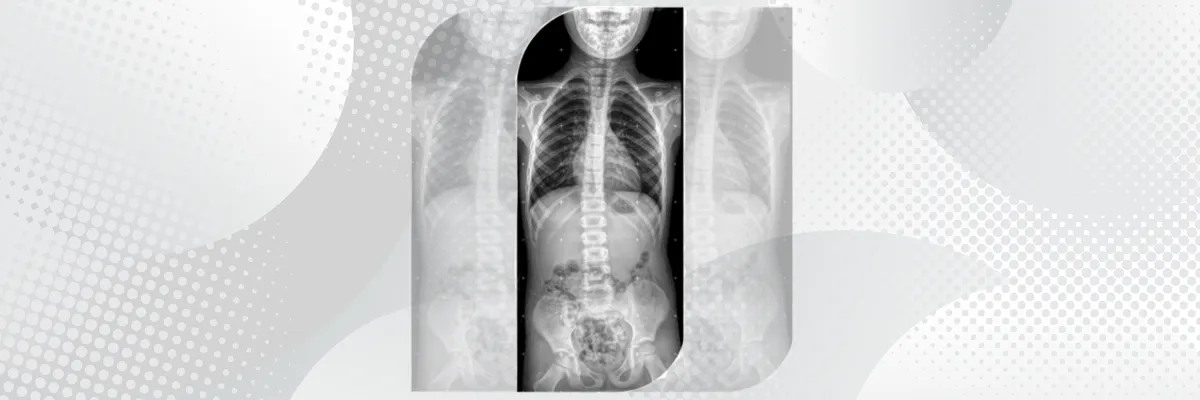 Radiología Convencional