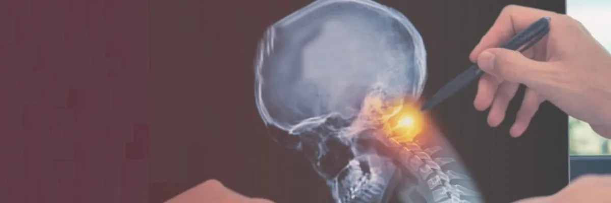 Multidisciplinario de Cáncer de Cabeza y Cuello