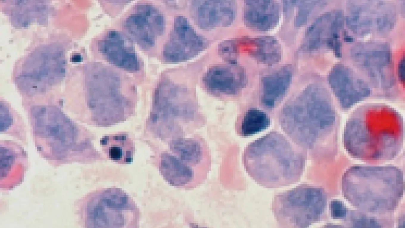 bacterias